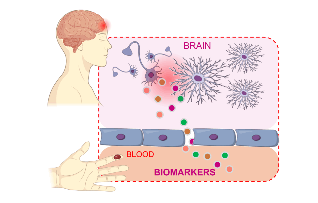 Illustration of biomarker and brain